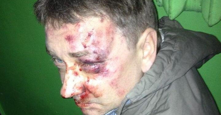 Yevhen Polozhii after being beaten